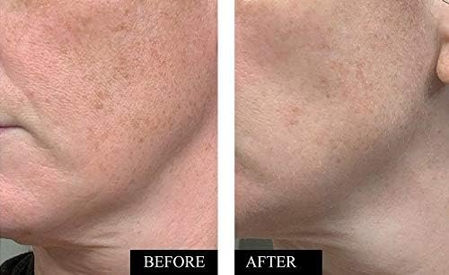 q honey, pure, raw honey, unpasteurised 1kg q honey, pure, raw honey, unpasteurised 1kg